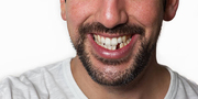 Regain Your Perfect Smile with the Best Prosthodontics Clinic in Triva